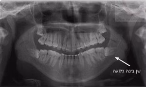 482d8b_97bcf48248de4d9a892376ae2901169b